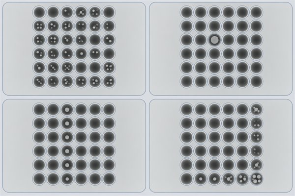 BGA void, four X-ray distribution patterns used to compare likely cause areas